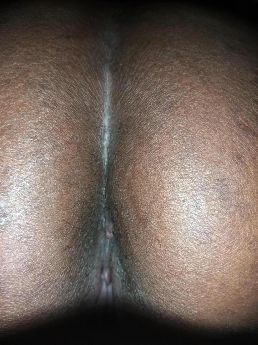 Stephani escort Fyn – billede 1 af 5