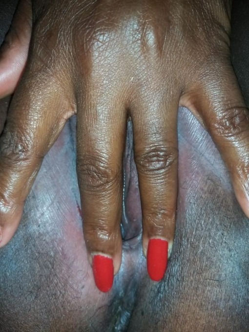 Stephani escort Fyn – billede 2 af 5